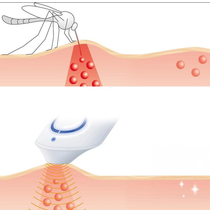 Beurer BR10 συσκευή θεραπείας τσιμπήματος κουνουπιού, Κατάλληλο για έγκυες γυναίκες και παιδιά, 300 εφαρμογές, Χωρίς χημικά, Τοπική εφαρμογή, Λευκό