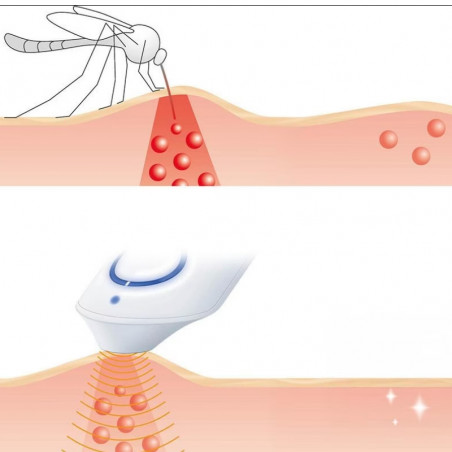 Beurer BR10 συσκευή θεραπείας τσιμπήματος κουνουπιού, Κατάλληλο για έγκυες γυναίκες και παιδιά, 300 εφαρμογές, Χωρίς χημικά, Τοπική εφαρμογή, Λευκό