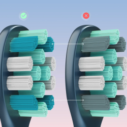 Ηλεκτρική οδοντόβουρτσα AENO ADB0010N, 5W, DuPont™, χρονοδιακόπτης, 5 λειτουργίες, 90 ημέρες με μία φόρτιση, μπλε