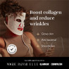 Φωτοθεραπευτική μάσκα προσώπου Silk'n LED Face Mask 100 FLM100PE1001, Αυτονομία 130 λεπτών, 4 λειτουργίες, Συνεδρία 10 λεπτών, Ευέλικτος σχεδιασμός, Λευκό