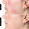 Φωτοθεραπευτική μάσκα προσώπου Silk'n LED Face Mask 100 FLM100PE1001, Αυτονομία 130 λεπτών, 4 λειτουργίες, Συνεδρία 10 λεπτών, Ευέλικτος σχεδιασμός, Λευκό